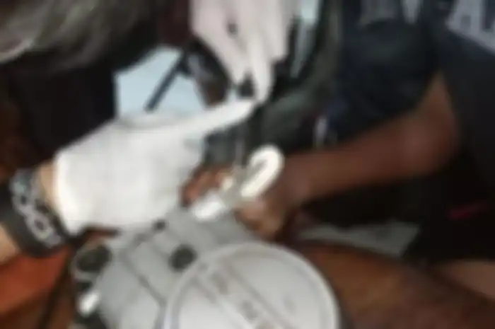 Jari seorang pemuda berumur 14 tahun di Surabaya, Jawa Timur, terjepit blok kopling motor.