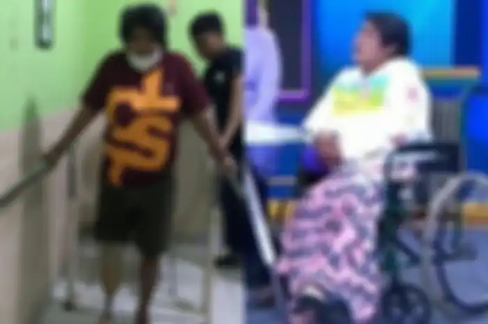 Suti Karno pakai kaki palsu pasca diamputasi