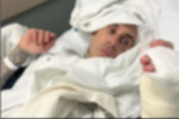 Update kondisi Travis Barker setelah menjalani operasi jari