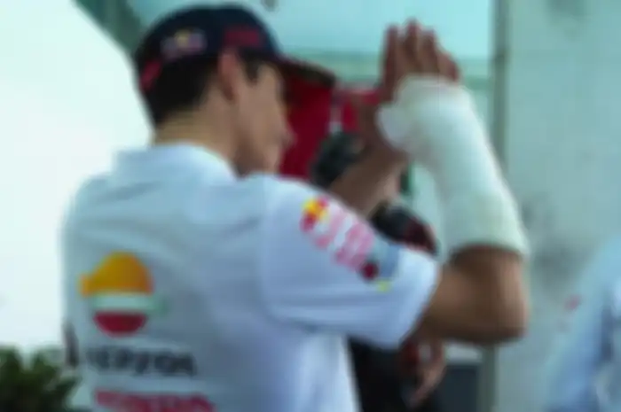 Marc Marquez mengalamai cedera tangan usai MotoGP Portugal 2023