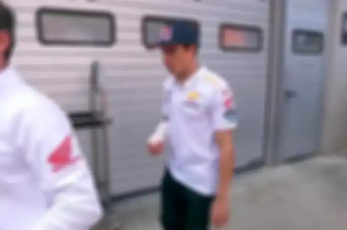 Marc Marquez cedera tulang metakarpal atau telapak tangan kanan. Retakan kecil dekat ibu jari yang membuatnya absen panjang. Apa perlu?