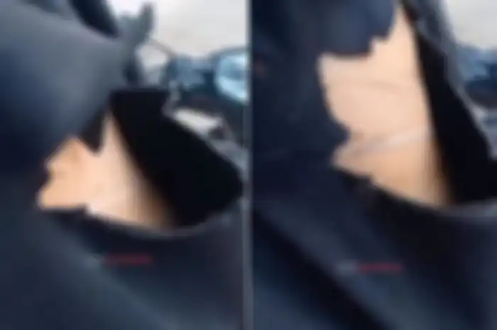 Pengendara motor di Semarang terkena benang layangan. Baju sampai robek hingga tembus melukai kulit.