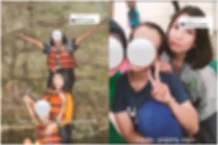 Ekspresi Eveline saat berfoto tanpa ekspresi karena gagal botox