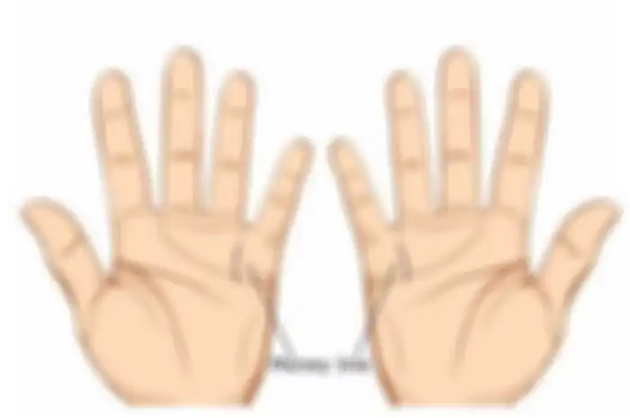 Ilustrasi garis tangan sial menurut ahli palmistry