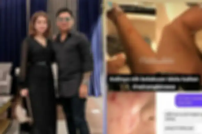 Sosok Umi Kalsum, istri Wirang Biwara yang sempat mengaku jadi korban KDRT