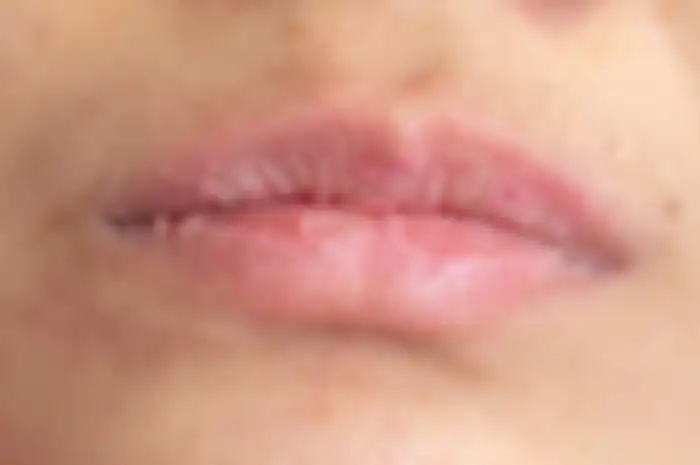 Ilustrasi kulit bibir kering