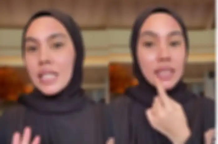 Kartika Putri Penyebab Luka Misterius di Wajahnya, Terkuak Bahwa sang Artis Idap Autoimun dan Steven Johnson Syndrome Selama 5 Tahun