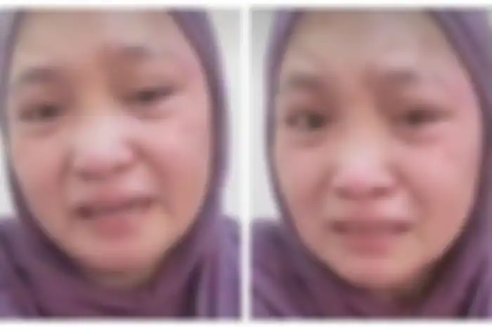 Penampakan wajah memar Nurul Huda, TKW asal Dompu usai menerima siksaan berkali-kali di Oman.
