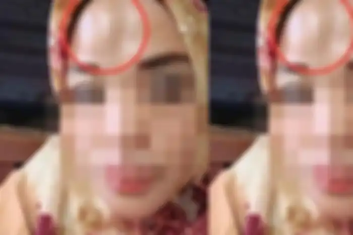 Wanita yang dihajar ustaz di Sulawesi