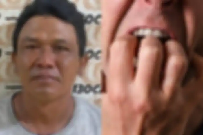 Botol, juru parkir liar yang gigit jari satpam gereja sampai putus