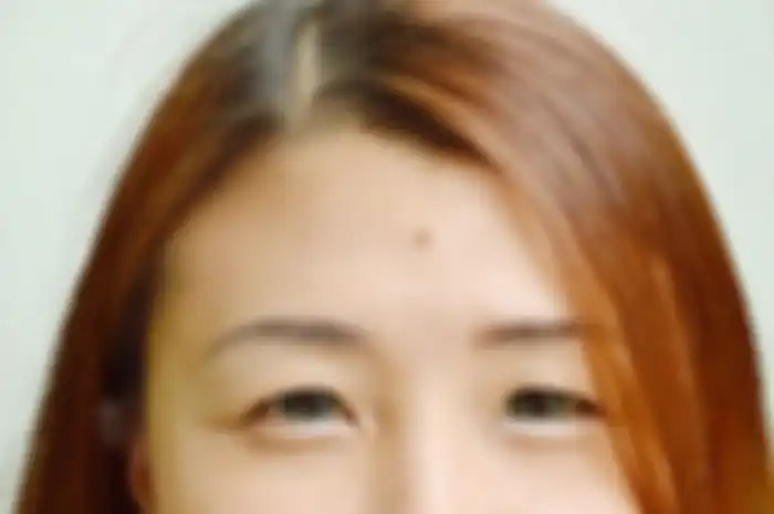 arti kedutan di kening kiri 