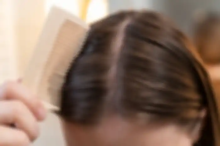 Penyebab rambut berhenti tumbuh