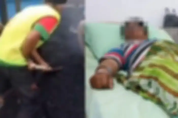 Ade Dian Firmansyah (36), driver ojol tertimbun aspal panas di Medan Sumatera Utara pada Sabtu (10/7/2024) lalu, korban teriak kepanasan dan diselamatkan warga sekitar. 