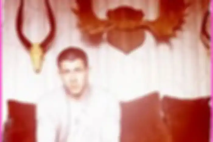 NICK JONAS : Tampil Botak