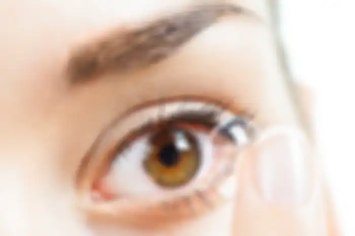 Kekurangan Dari Memakai Softlens