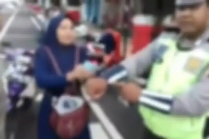 Polisi menunjukan luka ditangannya usai digigit emak-emak nekat.