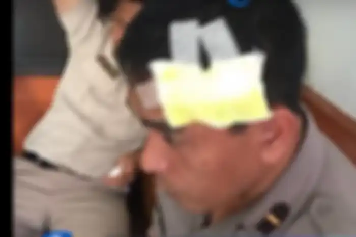 Seorang polisi korban pemukulan perwira menengah polisi.