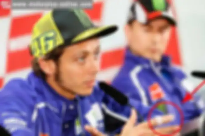 Valentino Rossi mengaku tidak bisa tampil maksimal di MotoGP seri XV yang berlangsung di sirkuit Motogi, Jepang, Minggu ini (12/10). The Doctor mengaku ada cedera yang cukup serius yang menghantui penampilannya di atas sepeda motor. Cedera ini salah 