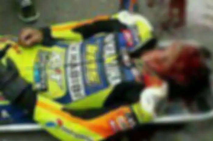 Dunia balap motor di Indonesia sedang berduka setelah satu orang pembalap nasional tewas menabrak pohon ketika balap.