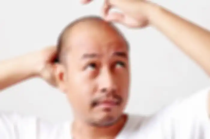 Rambut rontok memang bukan masalah medis serius, tapi dapat mengganggu penampilan.