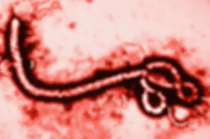 Virus Ebola masuk 0 virus paling berbahaya dan mematikan di dunia.