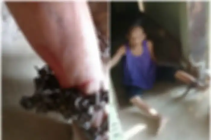 Saat ditemukan, kaki Chuam dirantai di sisi rumahnya. Rantai itu melukai kakinya.