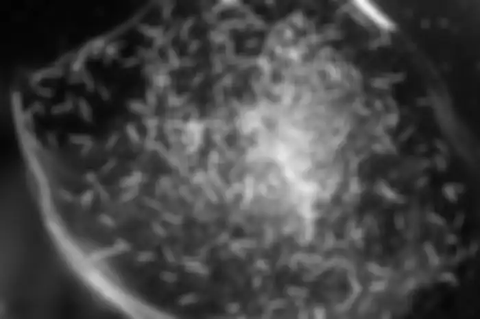 Spirostomum ambiguum dilihat dengan menggunakan mikroskop.