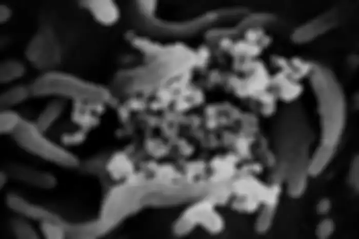 Gambar mikroskop elektron pemindai ini menunjukkan virus corona Wuhan atau Covid-19 (kuning) di antara sel manusia (merah). 