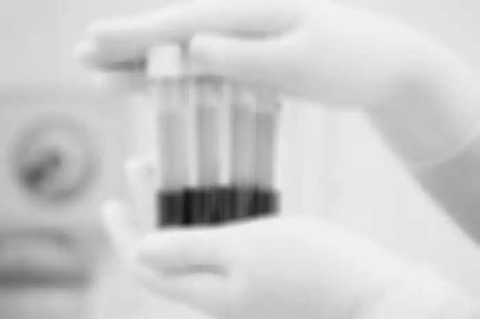 Terapi Plasma Konvalesen kini mulai diterapkan di Indonesia