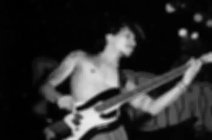 Kondisi Hubert Henry, Bassist Boomerang Kritis Usai Pecah Pembuluh Darah di Syaraf Otaknya