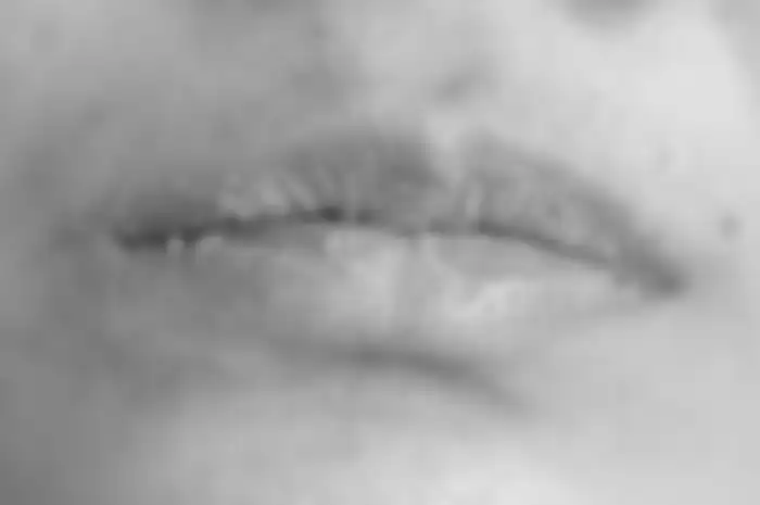 bibir kering dan pecah-pecah