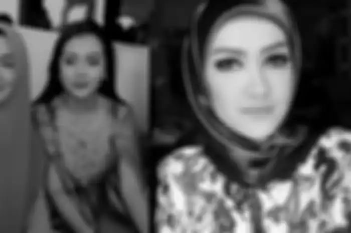 Sri Wulansih jadi korban tabrakan motor hingga dirawat di rumah sakit.