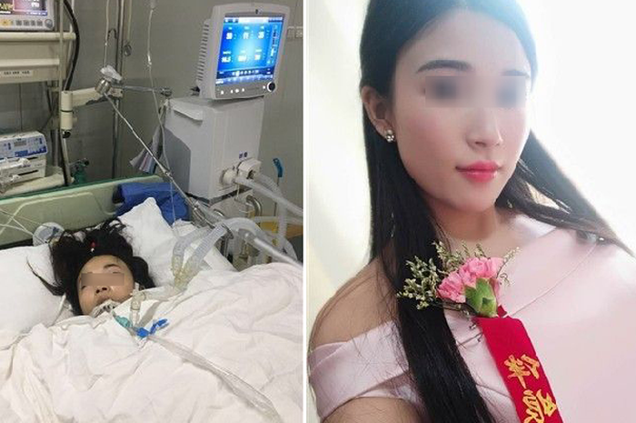 Hanya karena menjadi pengiring pengantin 2 hari berturut-turut wanita ini alami hal mengerikan, kakinya terpaksa dimputasi.