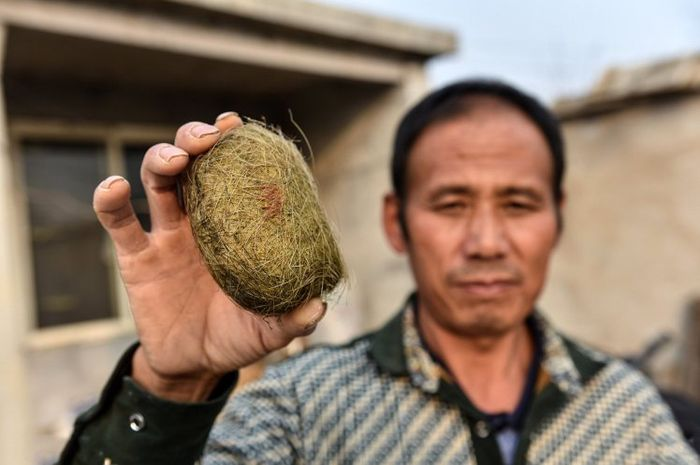 Babi dengan berat sekitar 250 kg itu punya batu empedu besar di dalam kandung empedunya saat ia terbunuh.