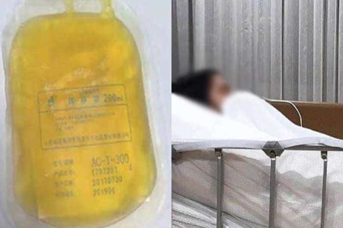 Darah wanita ini berubah jadi kuning karena sering makan makanan yang disukai banyak orang ini, dokter pun sampai terkejut!