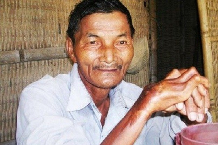 Ngoc menjalani kehidupan normal terakhir hingga tahun 1973, setelah ia mengalami demam pada tahun tersebut ia mulai tidak bisa tidur.