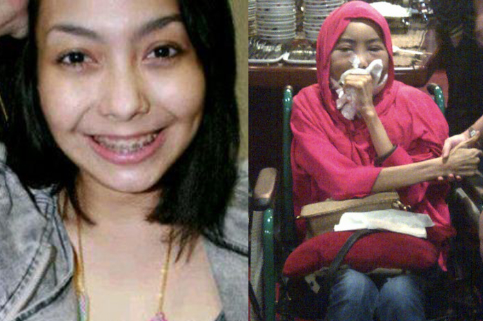 Artis FTV ini meninggal saat masih muda karena kanker lidah, kebiasaan konsumsi makanan dan minuman seperti ini bisa jadi penyebabnya.