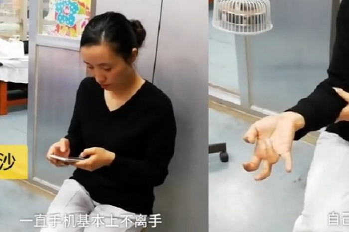Jari kaku karena megang hape terus 