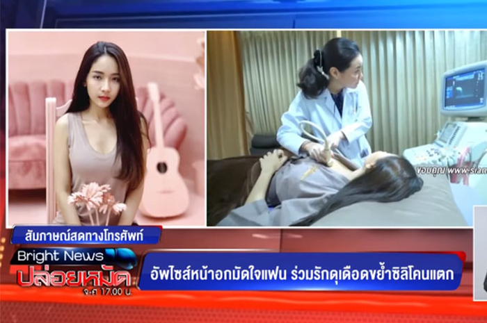 Wanita ini baru menyadari implan payudaranya pecah setelah satu tahun kemudian.