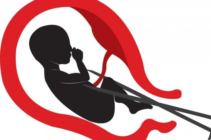 Ilustrasi aborsi.