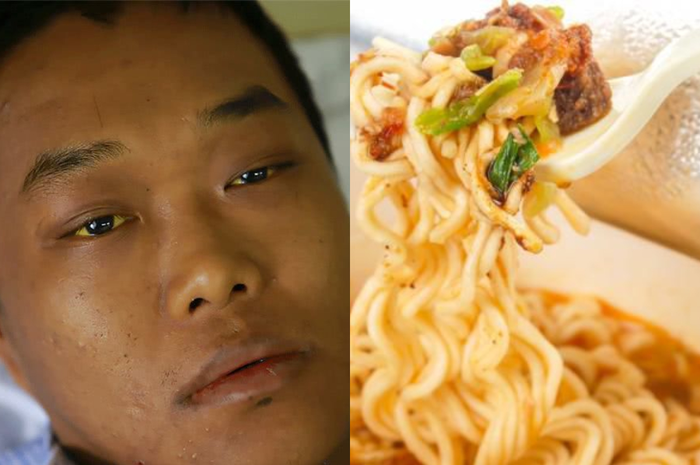 Kasus ini menjadi bukti bahwa begadang dan makan mie instan adalah hal berbahaya, pria asal Filipina ini divonis 16 penyakit,