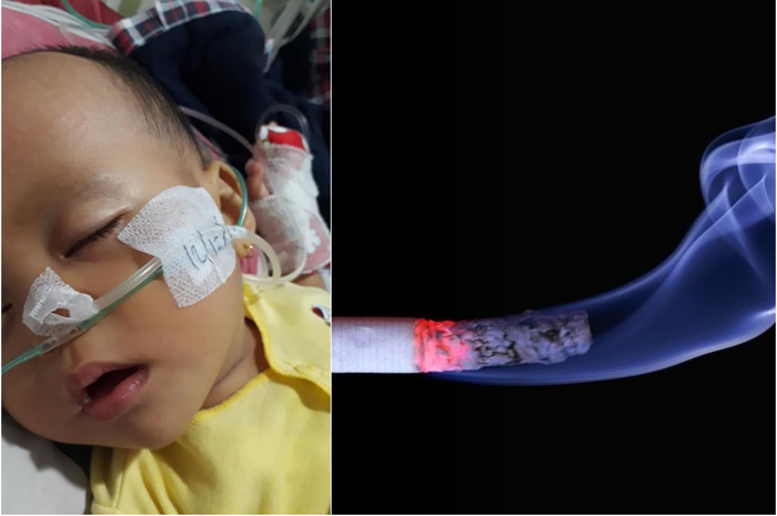 Gegara sang ayah adalah perokok, bayi ini harus menderita karena penyakit ini. Begini cara efektif agar bisa berhenti merokok.