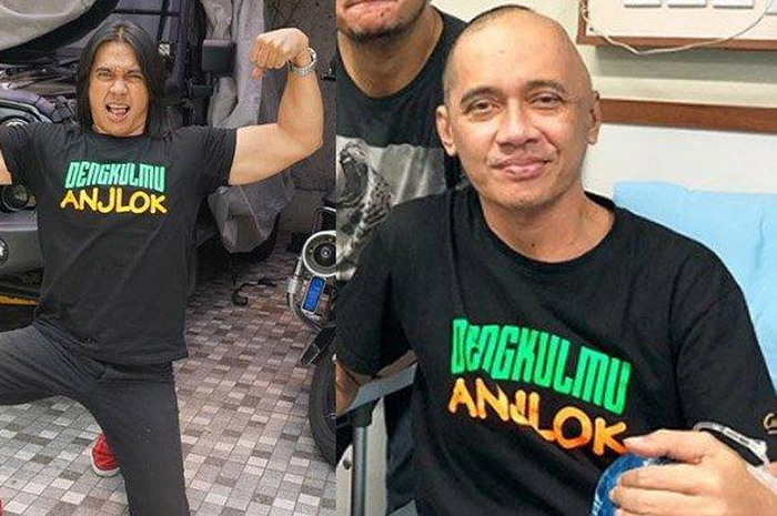 Sempat 3 kali operasi kanker otak sebelum meninggal, sahabat ceritakan saat mengangkat jenazah Agung Hercules.