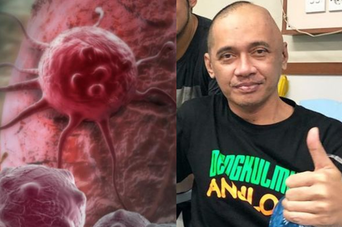 Banyak penelitian yang menunjukkan bahwa kanker dapat dilawan dan dicegah dengan menjalani pola hidup sehat.