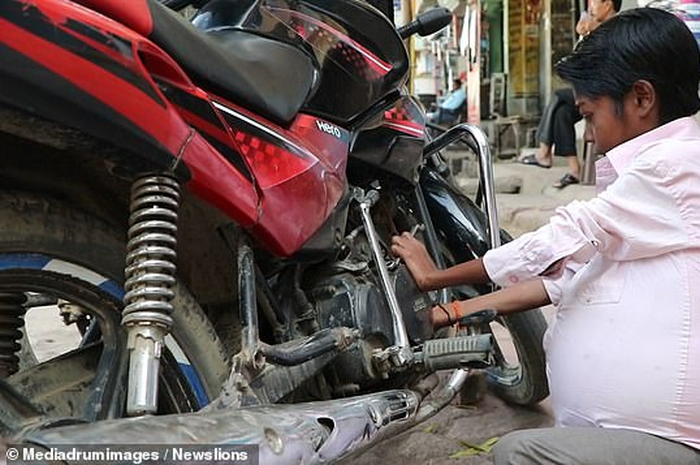 Mekanik sepeda ini mendapati perutnya semakin membesar sejak ia masih kecil. Sayang, tidak seorang dokter pun mampu mendiagnosisnya.