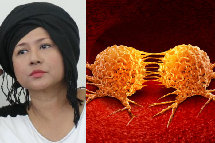 Metastasis atau penyebaran sel kanker seperti yang dialami oleh Ria Irawan ternyata bisa dipicu oleh karbohidrat yang kita asup.