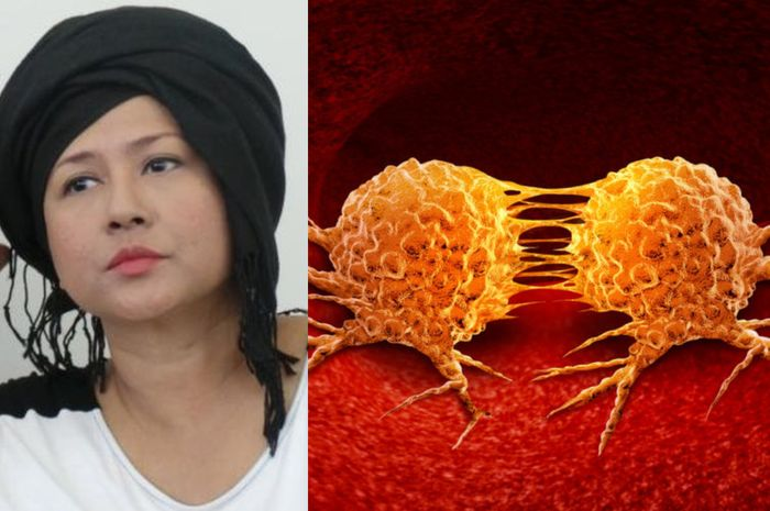 Artis seni peran Ria Irawan dikabarkan menjalani perawatan di rumah sakit lagi setelah sel kankernya kembali aktif dan mengalami metastasis.