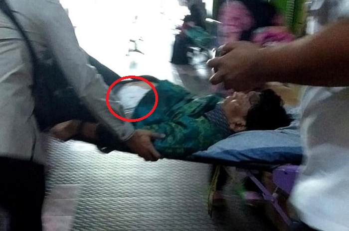 Kondisi Wiranto Saat Ditandu Akibat Luka Tusuk Yang Dia Terima.