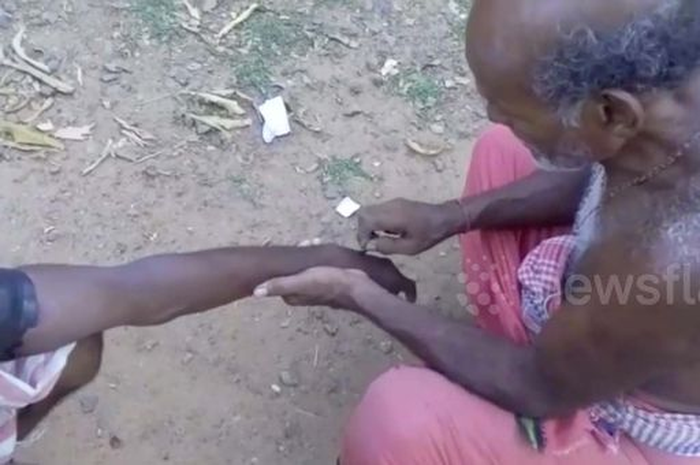 Kisah berikut ini bisa sedikit menjelaskan pada Anda bagimana orang tradisional mengobati korban yang terkena gigitan ular beracun.