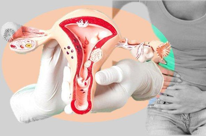Perhatian buat para wanita, sebaiknya hindari 4 jenis makanan ini yang bisa sebabkan kista. Jangan sampai jadi petaka buat diri sendiri.